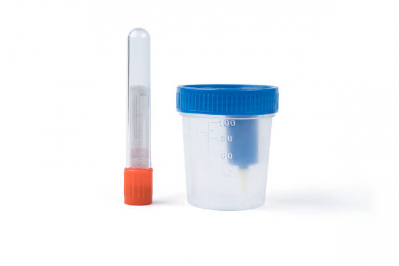 Clínica de Coleta de Urina para Exame Toxicológico Próximo a Mim Cedro - Clínica de Coleta de Amostras para Exames Toxicológicos