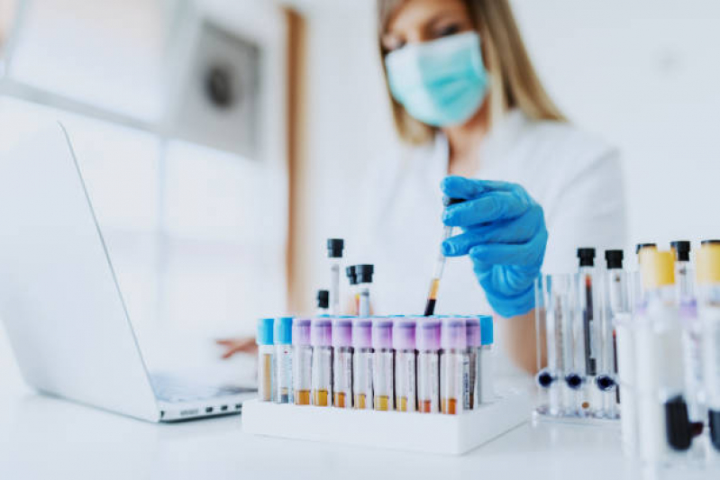 Clínica para Exame Laboratorial Amilase Milagres - Exame Laboratorial de Hormônio