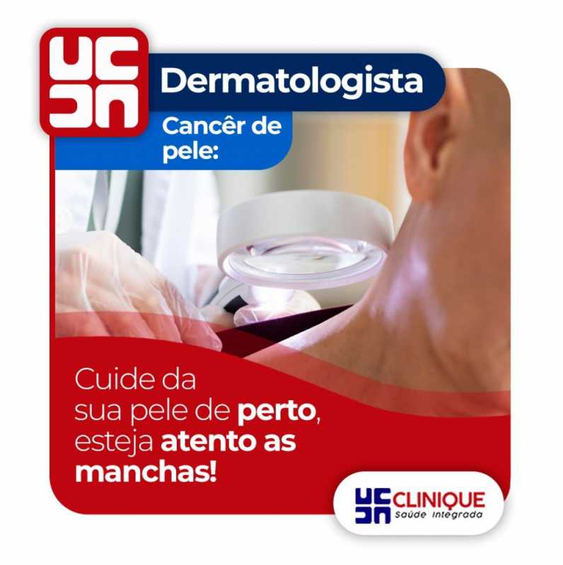 Dermatologista Especialista em Doenças de Pele Maracanaú - Dermatologista Juazeiro do Norte
