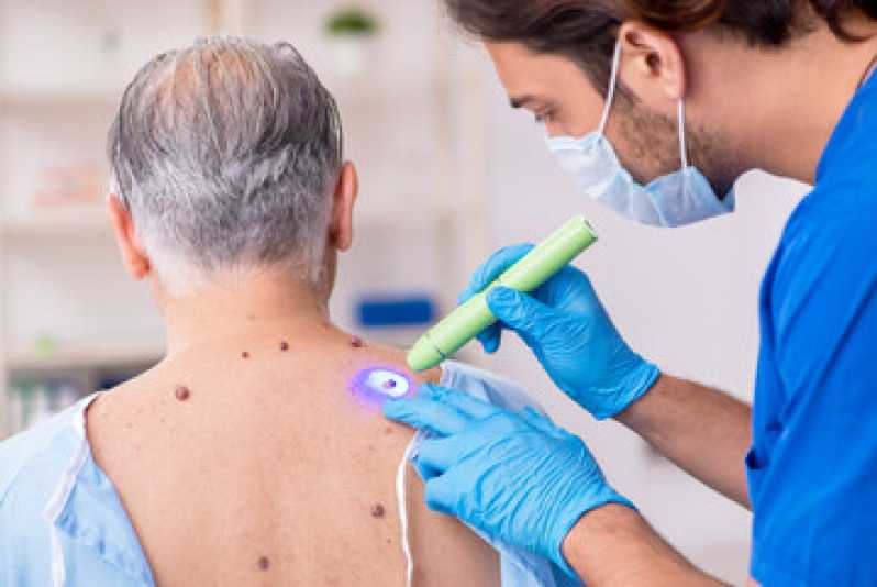 Dermatologista Especialista em Unha Encravada Marcar Araripina - Dermatologista Especialista em Cicatriz