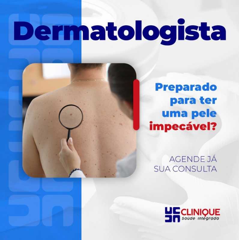 Dermatologista Potengi - Dermatologista Juazeiro do Norte