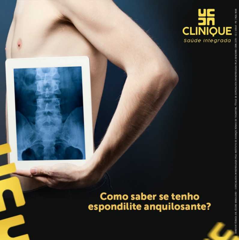 Exame de Imagem Pulmão Agendar Iguatu - Exame de Radiografia