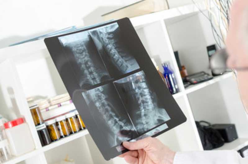 Exame de Radiografia Agendar São José de Belmonte - Exame de Imagem da Coluna