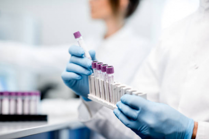 Exame Laboratorial Amilase Agendar Porteiras - Exame Laboratorial Hepatite