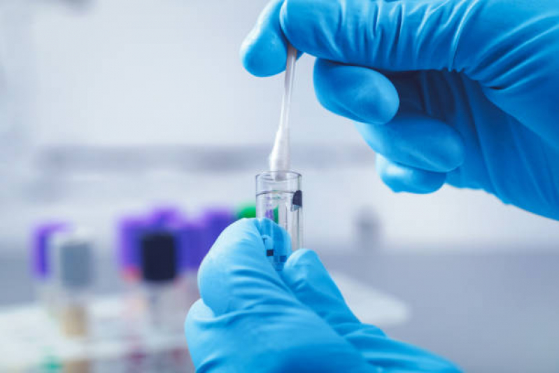 Exame Laboratorial Hepatite Agendar TRINDADE - Exame Laboratorial de Hemograma