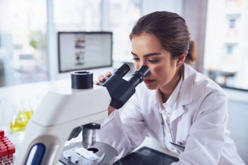Exame Laboratorial para Check Up Milagres - Exame Laboratorial Hepatite