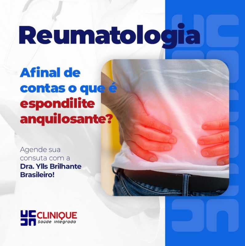 Reumatologista Pajeú - Reumatologista Mais Próximo