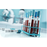 clínica para exame laboratorial para check up Petrolina
