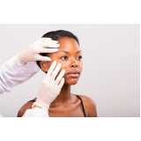 dermatologista especialista em acne Porteiras