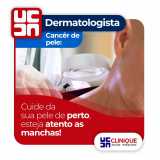dermatologista especialista em doenças de pele Sertânia