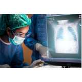 exame ultrassonografia agendar Barro
